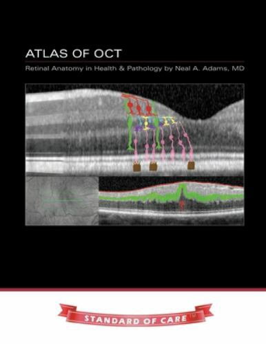 Atlas of OCT: Retinal Anatomy in Health & Pathology by Adams, Neal, Like New …