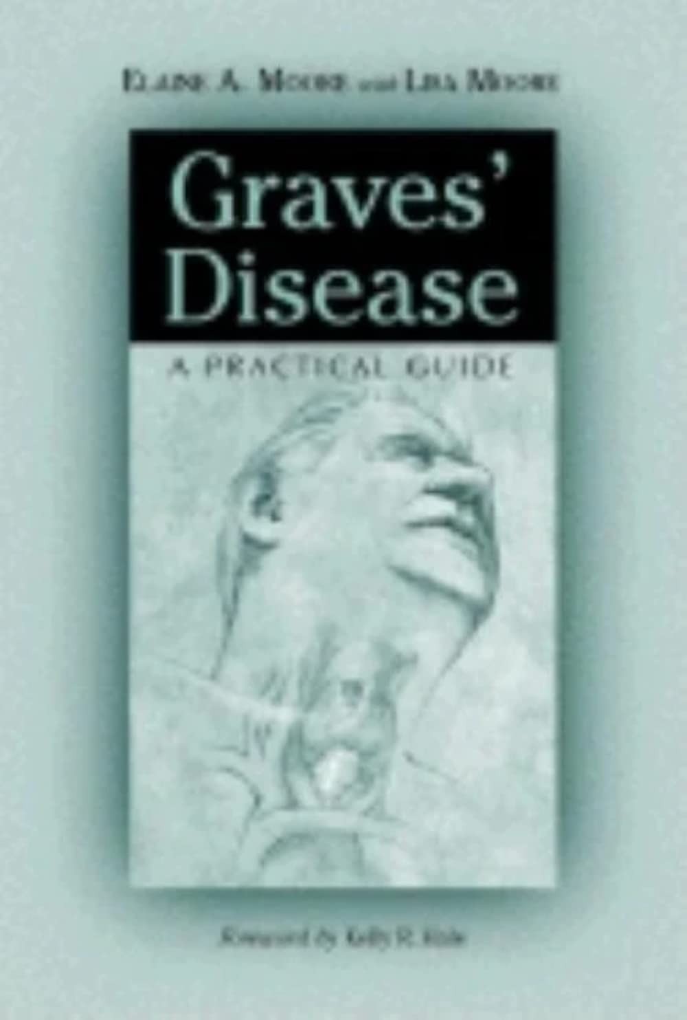 Graves’ Disease: A Practical Guide (McFarland Health Topics) – paperback Moo…
